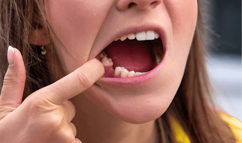 dental